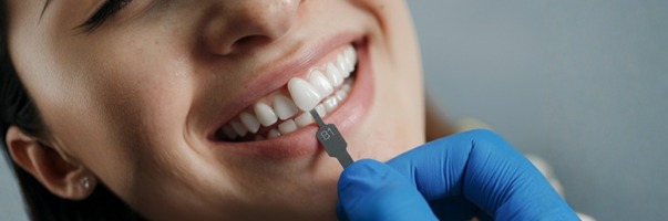 Facetas de Porcelana